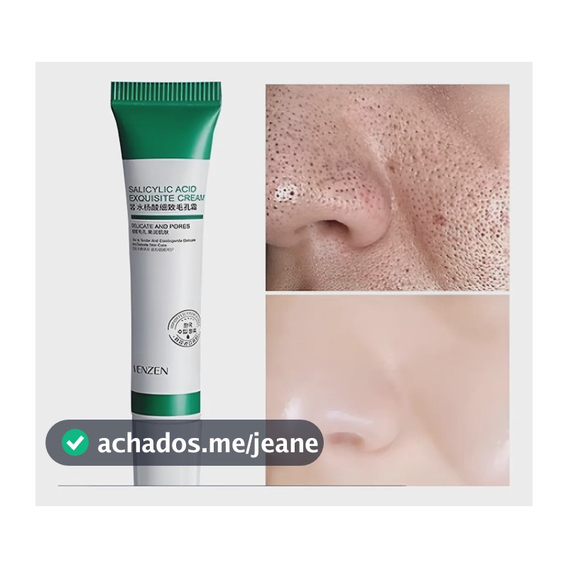 Creme De Ácido Salicílico Para Remoção De Poros Acne 20g Normal