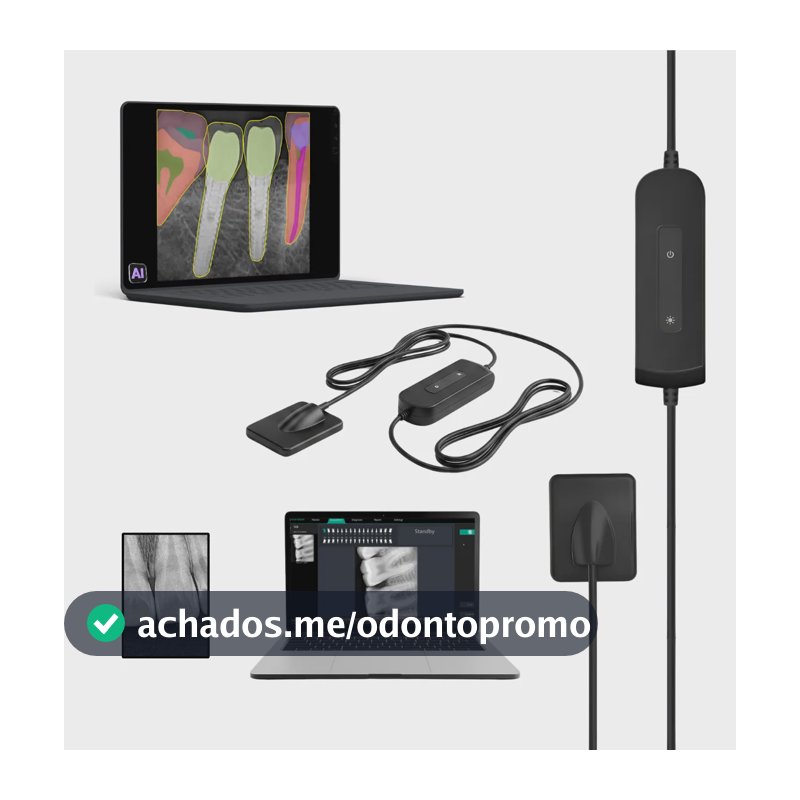 Sensor Digital Raio X Odontológico Periapical Usb Neox