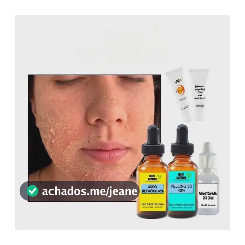 Kit 3d Completo:retinoico + Peeling 3d + Tca + Vit C+ Sabone