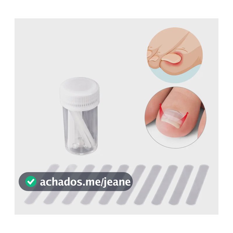 Kit 10 Fibras Órtese Rígidas Unha Encravada Correção Fitas