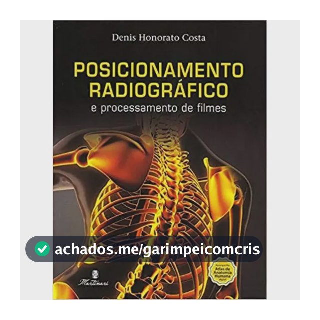 Posicionamento Radiográfico e Processamento de Filmes | Atlas Digital via QR Code | Ricamente Ilustrado | Editora Martinari
