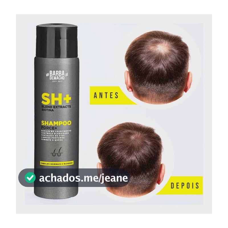 Shampoo Sh Force + Zero Queda E Oleosidade Masculino 300ml