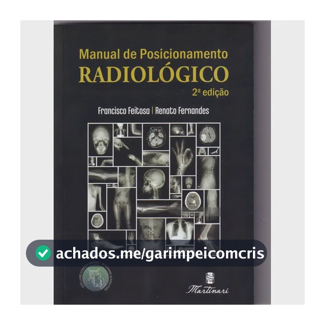 Manual de Posicionamento Radiológico de Bolso | Técnicas Básicas de Radiologia Totalmente Colorido com Realidade Aumentada | Editora Martinari